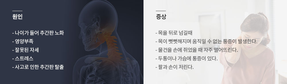 목 디스트의 원인과 증상