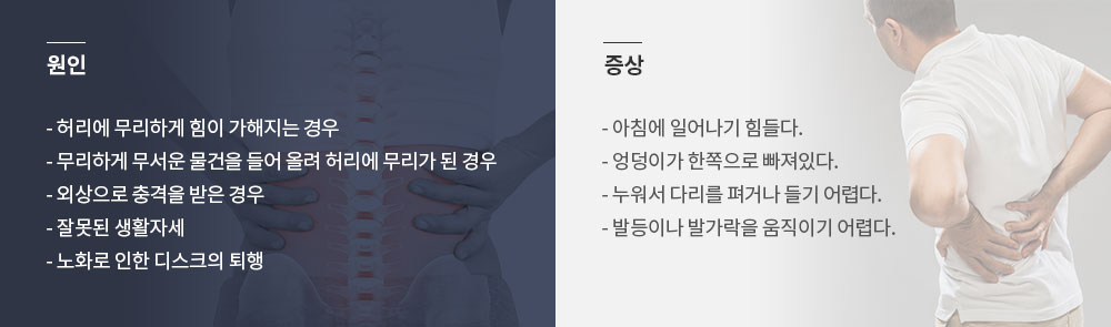 허리 디스크의 원인과 증상