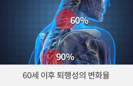 협착증 변화율