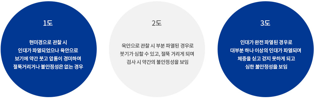 발목인대 손상 3단계